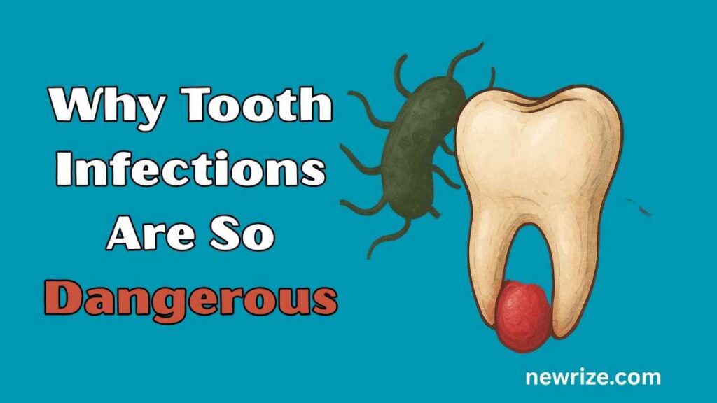 Why Tooth Infections Are So Dangerous